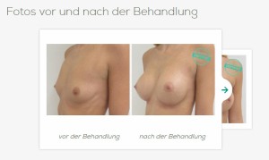 Schönheits- und Brust-Operation in Tschechien